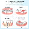 Enhebradores de hilo dental para frenos, puentes e implantes, 150