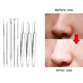 JINYJIA Blackhead Remover, Comedone Squeezer, Set of 6, Stainless Steel Acne Needle Set, Pimple Extractor Tool, Pimple Remover Kit with Box, for Facial Impurities such as Pimples, Acne, Blackheads