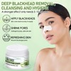 30g Nose Masks,Blackhead remover nose masks, Deep Cleansing Pore, Keep