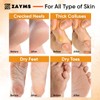 ZAYMS Foot Peeling Mask 5 Pack - Exfoliating Mask for