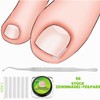 50 Pieces Nail Clips Set for Correction Ingrown Toenails, Toenail