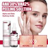 Bluemega Solución Exfoliante, AHA 30% + BHA 2% Esencia de