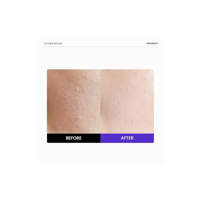 FRANKLY Closer Serum | Pore Minimizer Serum | 1.01 fl