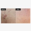 VT Cosmetics [VT Cosmetics]Reedle Shot 100 Stick 2ml (10ea)