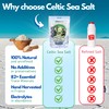 Celtic Sea Salt – 100% Natural Unrefined Celtic Sea Salt