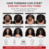63 Anti-Hair Loss Shampoo, Complex Hair Growth Shampoo Stimulating for