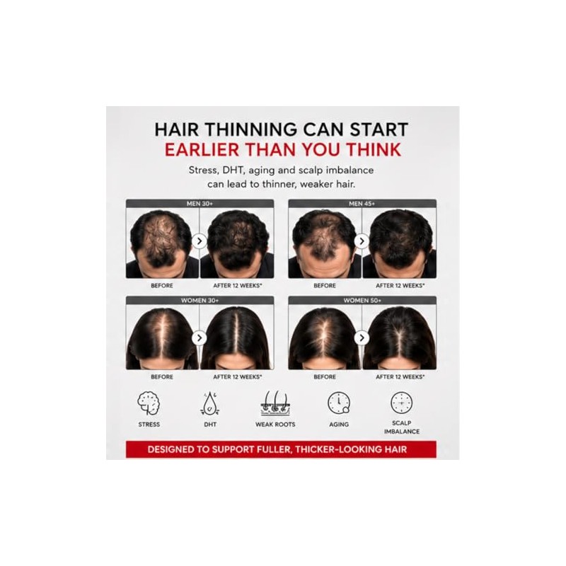 63 Anti-Hair Loss Shampoo, Complex Hair Growth Shampoo Stimulating for