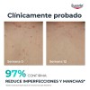 Eucerin DermoPure Triple Effect Crema Corporal, Piel Grasa e Imperfecciones,