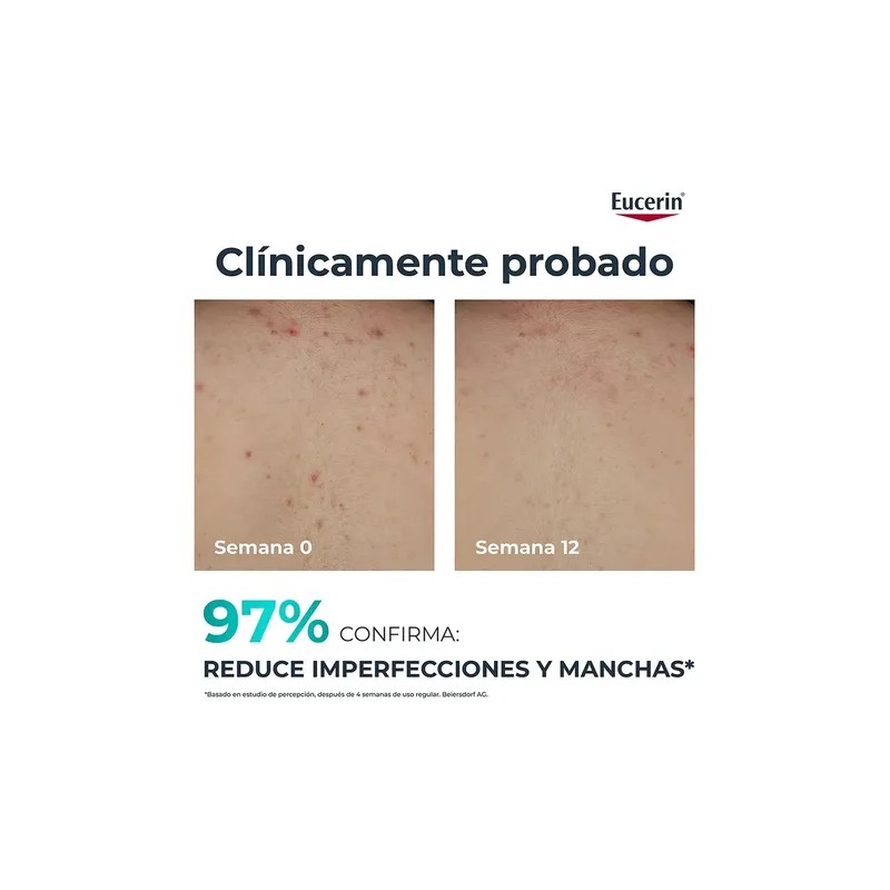 Eucerin DermoPure Triple Effect Crema Corporal, Piel Grasa e Imperfecciones,
