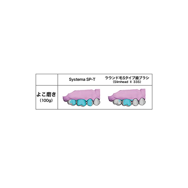 Lion Dental System SP-T Toothbrush (4 Pack)