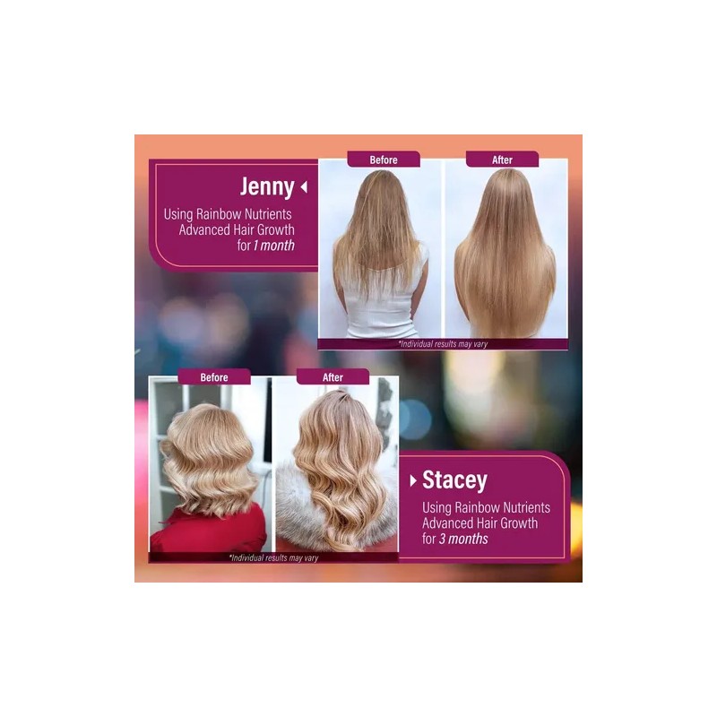 Vitaminas Para El Crecimiento Del Cabello Para Mujeres