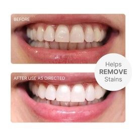 Nu Skin AP24 Whitening Fluoride-Free Toothpaste | Apply to Toothbrush and Rinse with Water | Teeth Whitening | Bright Smile | Safe for Kids | Whitening Toothpaste | Removes Plaque | 4 oz | 2 Pack