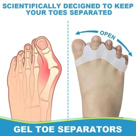 2 Pcs Toe Separators for Women & Men - Silicone Children Newborn Adult Toe Spacers for Overlapping Toes, Bunions, Hammer Toe, Toe Straightener for Foot Pain Relief ([3 months - 4 years old] White)