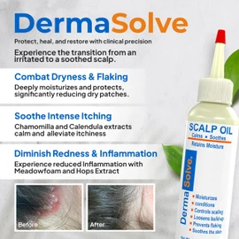 Dermasolve Psoriasis & Dandruff Oil, Dermatologist Approved for Flaky Scalp Relief