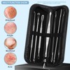 Teenitor 7 in 1 Pimple Popper Tool Kit - Blackhead