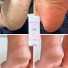 Crema Hidratante Para Pies, Hidratante De Larga Duración