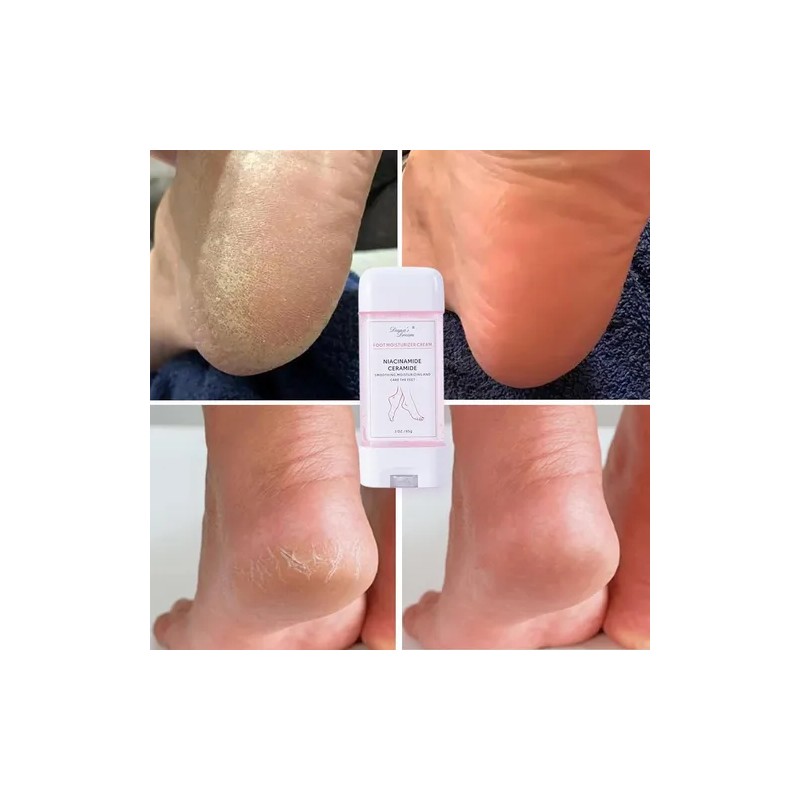 Crema Hidratante Para Pies, Hidratante De Larga Duración