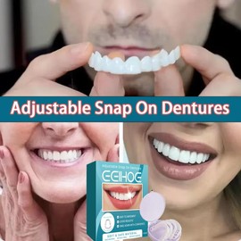 EELHOE Adjustable Buckle Denture, Temporary Fillings Interdental Fillings Orthodontic Denture Kits dental care repair set - Specification: 1pcs