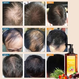 Batana Rosemary Onion Shampoo Hair Growth, Reducir Pérdida Cabello, Aceite Batana, Romero, Extracto Cebolla Mantenimiento Cabello Duradero, Reparar Ca