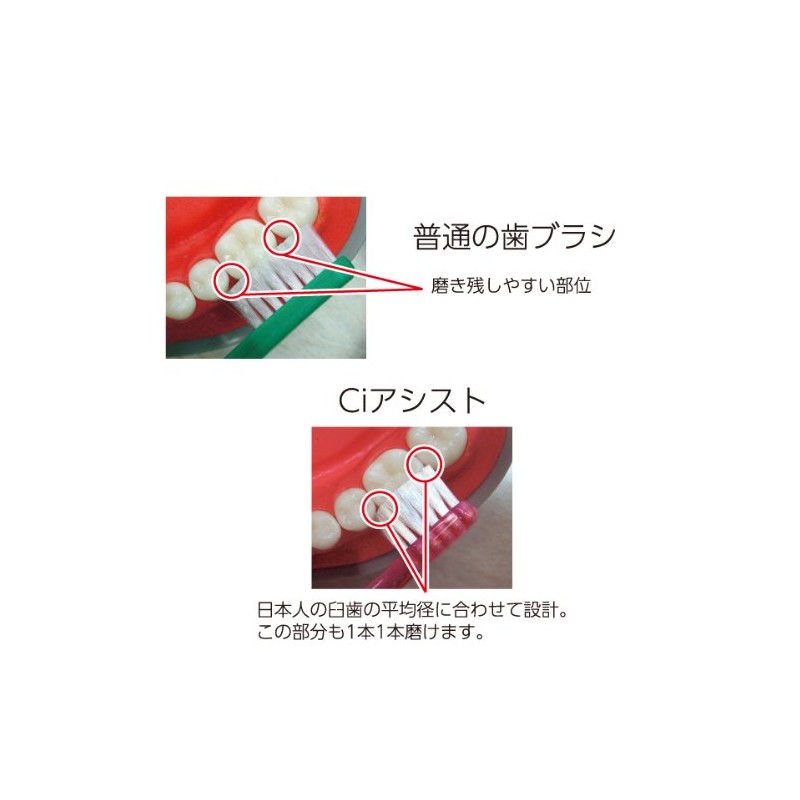 Ci Assist / Soft / Pack of 10