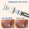 VITCOCO HD Ear Scope with Camera - 1920P WiFi Otoscope
