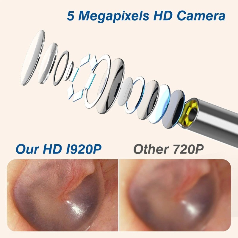 VITCOCO HD Ear Scope with Camera - 1920P WiFi Otoscope