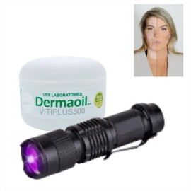 Crema De Melagenina Y Piperina Para Vitíligo + Lampara Uv