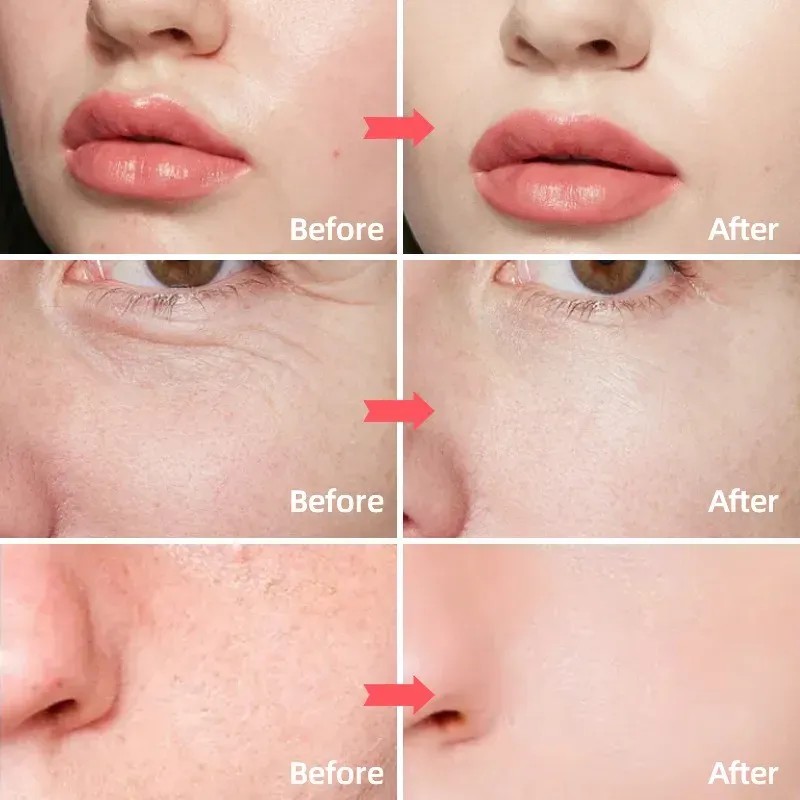 Crema Antienvejecimiento M Sxx Hh Con Retinol, Colágeno Y