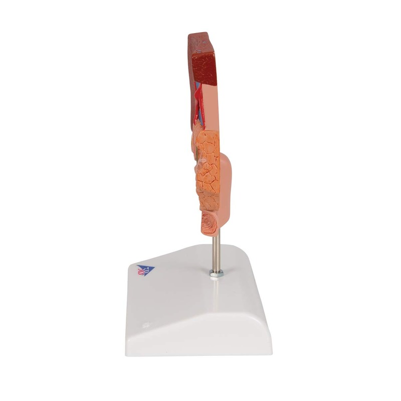 3B Scientific Human Anatomy - Gallstone Model + Free Anatomy