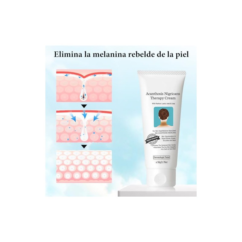 Pcs Acanthosis Nigricans Crema Mejora Pigmentación Unifica Tono Piel Hidrata