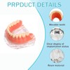 Dental Model Overdenture Transparent Dental Implants Model Detachable Model Lower