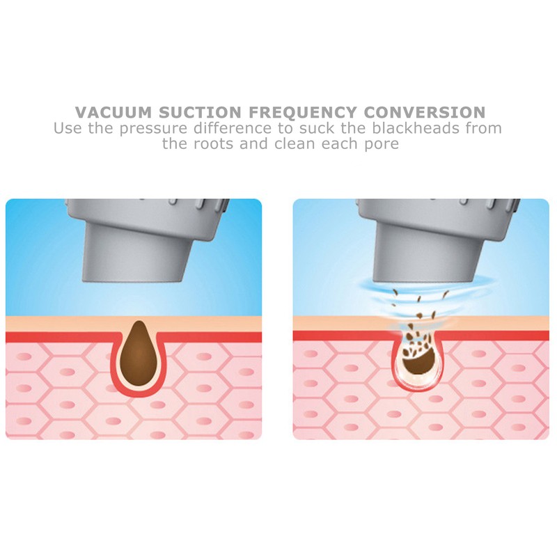 Small Bubble Pore Cleaner 4 Suction Head Electric Blackhead Removal