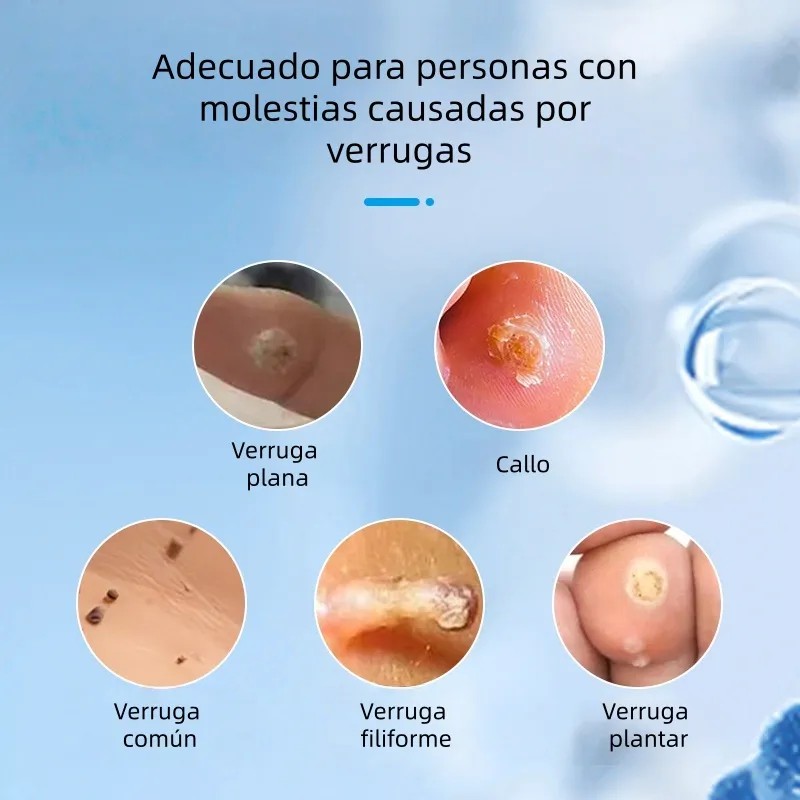Bolígrafo Reparador De Verrugas, Seguro E Indoloro