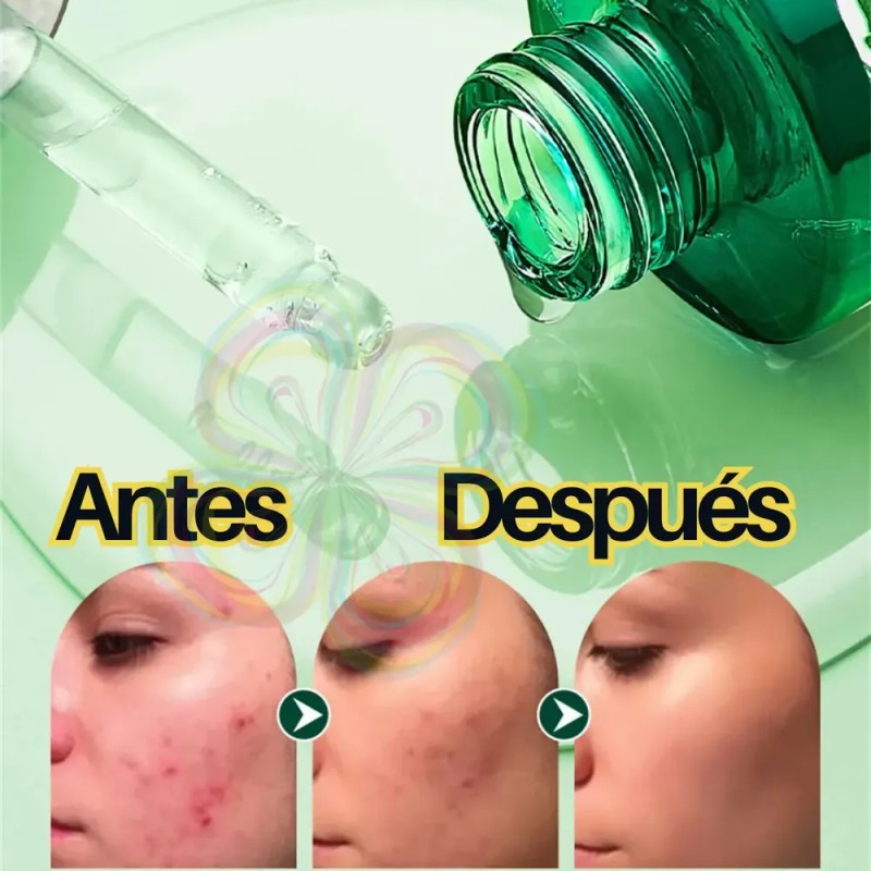 Kit Serum Vitamina C Ácido Hialuronico Salicílico Rodillo 4p