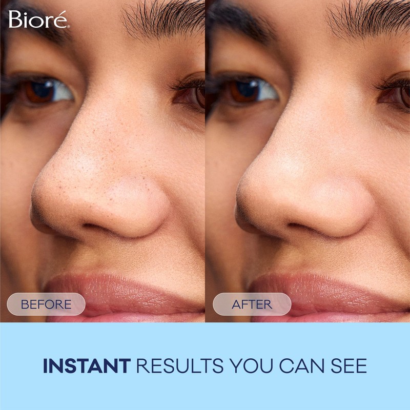 Bior Biore Deep Cleansing Pore Strips For Nose - 14