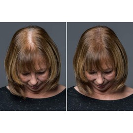 VOLUME HAIR+® Fibers MITTELBRAUN - zur Haarverdichtung für Frauen & Männer 12g - Streuhaar | Schütthaar | Haarfaser für tollen Echthaar Haareffekt - Haar Puder Applikator