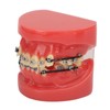 Professional Dental Demonstration Orthodontic Model with Metal Wires and Bracket
