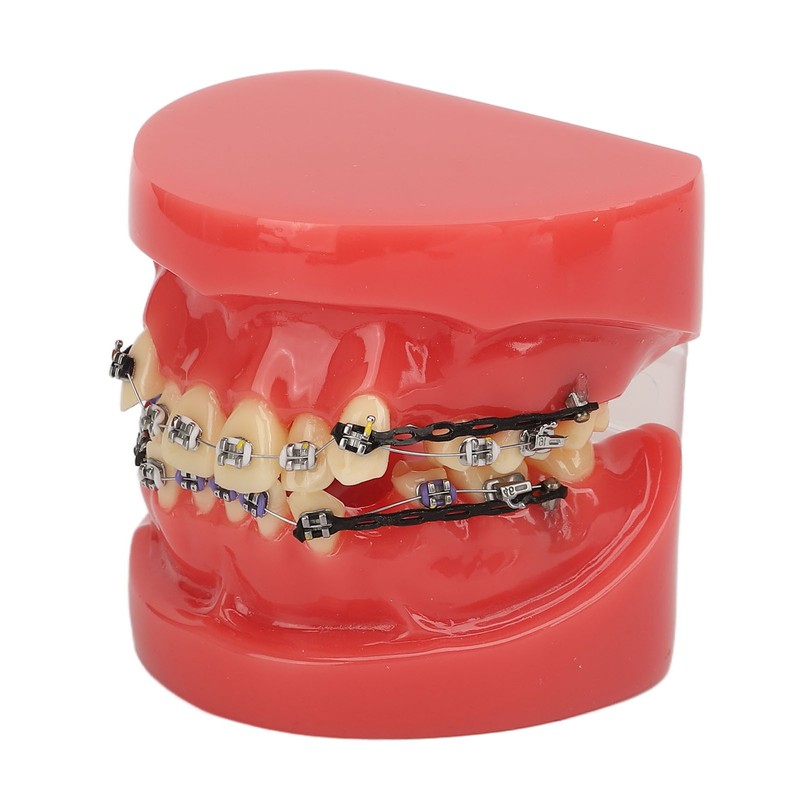 Professional Dental Demonstration Orthodontic Model with Metal Wires and Bracket