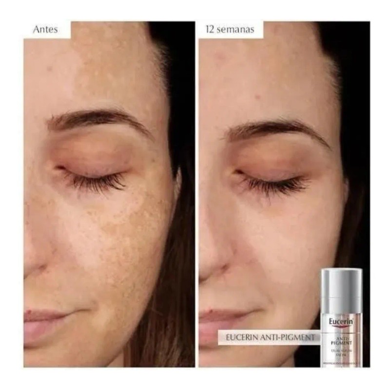 Antipigment Serum Dual Despigmentante Con Ácido Hialurónico Todo Tipo De