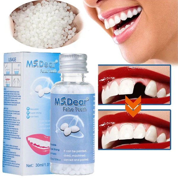 MS.DEAR Tooth Repair Beads Granules Temporary Tooth Glue Reusable Moldable
