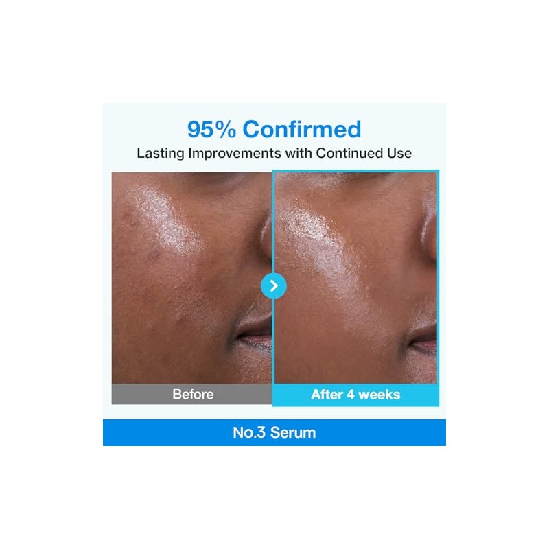 No.3 Blue Bio-Retinol Pore Refining Serum 1.3ml*10EA