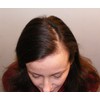 Mane Hair Thickener Direct from the Manufacturer for hair loss