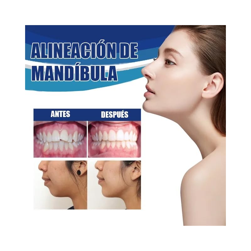 Retenedor De Dientes Para Corrección De Sonrisa. Dispositivo de Ortodoncia