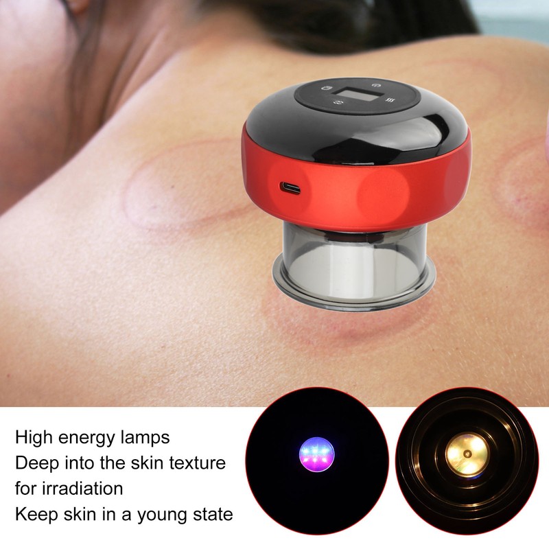 Electric Cupping Therapy Massager Negative Pressure 6 Gears Hot Compress