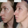 SKINICIAN Purifying Day Moisturiser SPF30 - Lightweight Moisturising Face Cream