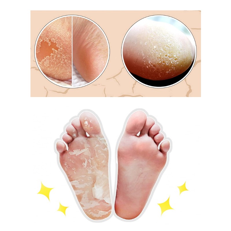 Dear and Derm Double Effect! DearDerm Foot Peel Mask, Peeling