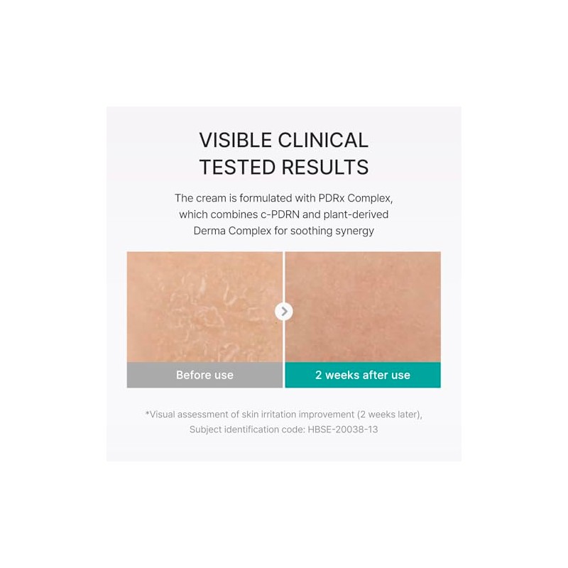 REJURAN® Moisture Cream, c-PDRN® - Daily Moisturizer for Long-Lasting Hydration