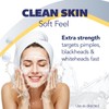 Asepxia Acne Treatment Neutral Hypoallergenic Bar Soap | 2% Salicylic