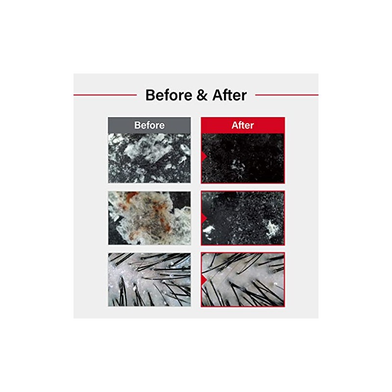 Dr.FORHAIR Folligen Sea Salt Scaler Biotin Scalp Scrub (10.5oz) Hair