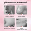 Gel Exfoliante QUARXERY con Hamamelis y Regaliz para Rostro 50g